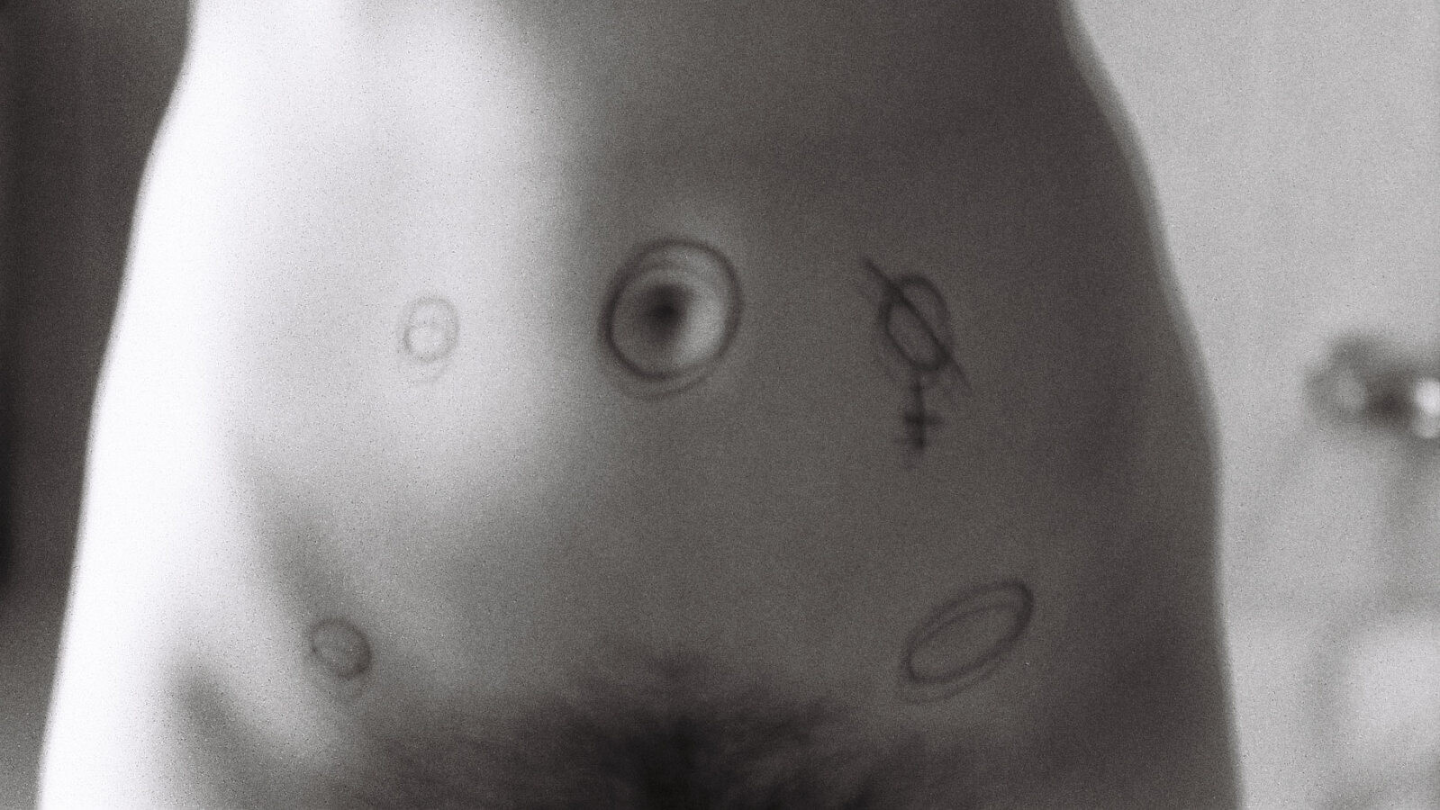 Endometrióza je tělesná zkušenost, ne genderová identita