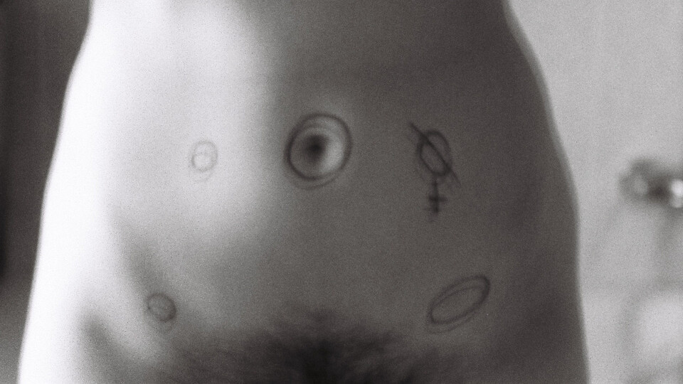 Endometrióza je tělesná zkušenost, ne genderová identita