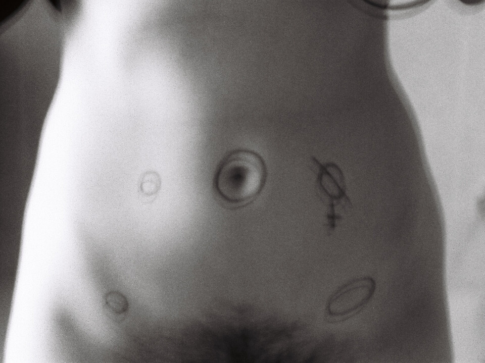 Endometrióza je tělesná zkušenost, ne genderová identita